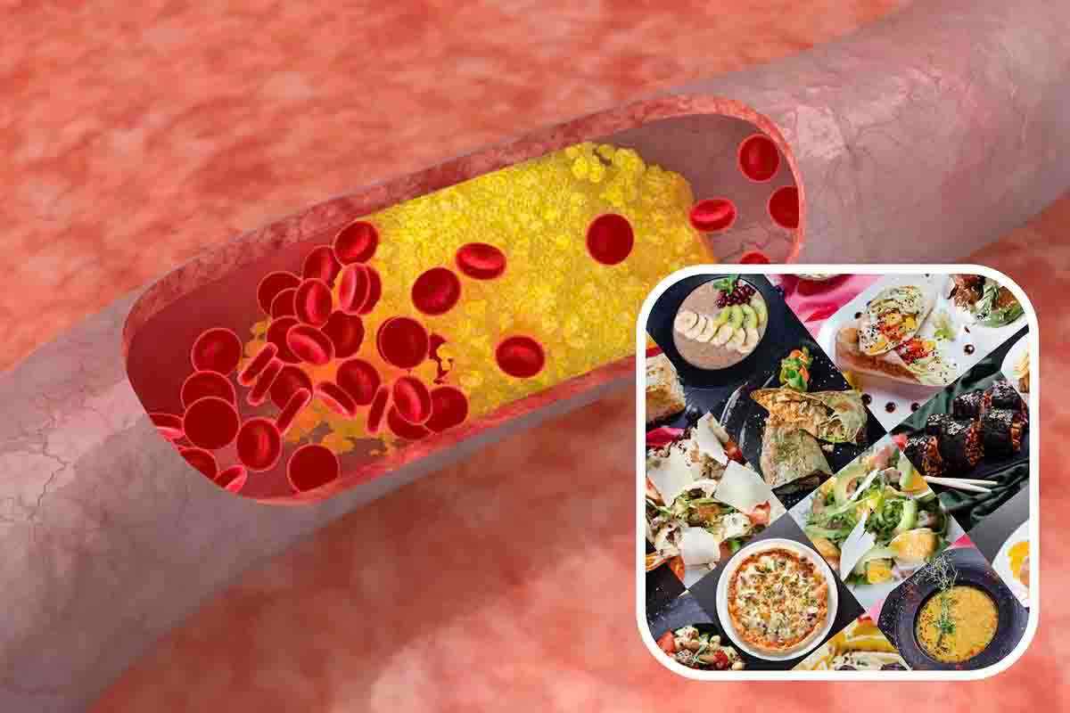 alimenti contro colesterolo e trigliceridi