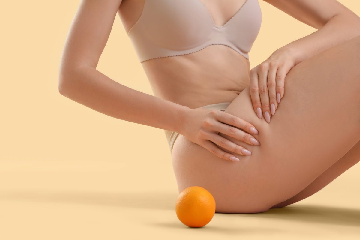 Mi é bastato seguire il consiglio del mio nutrizionista per vedere la cellulite (quasi) sparire: chi lo immaginava